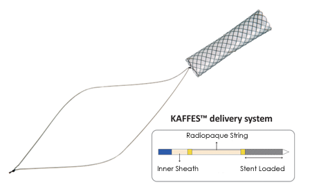 Niti-S Biliary Interventional Kaffes Stent